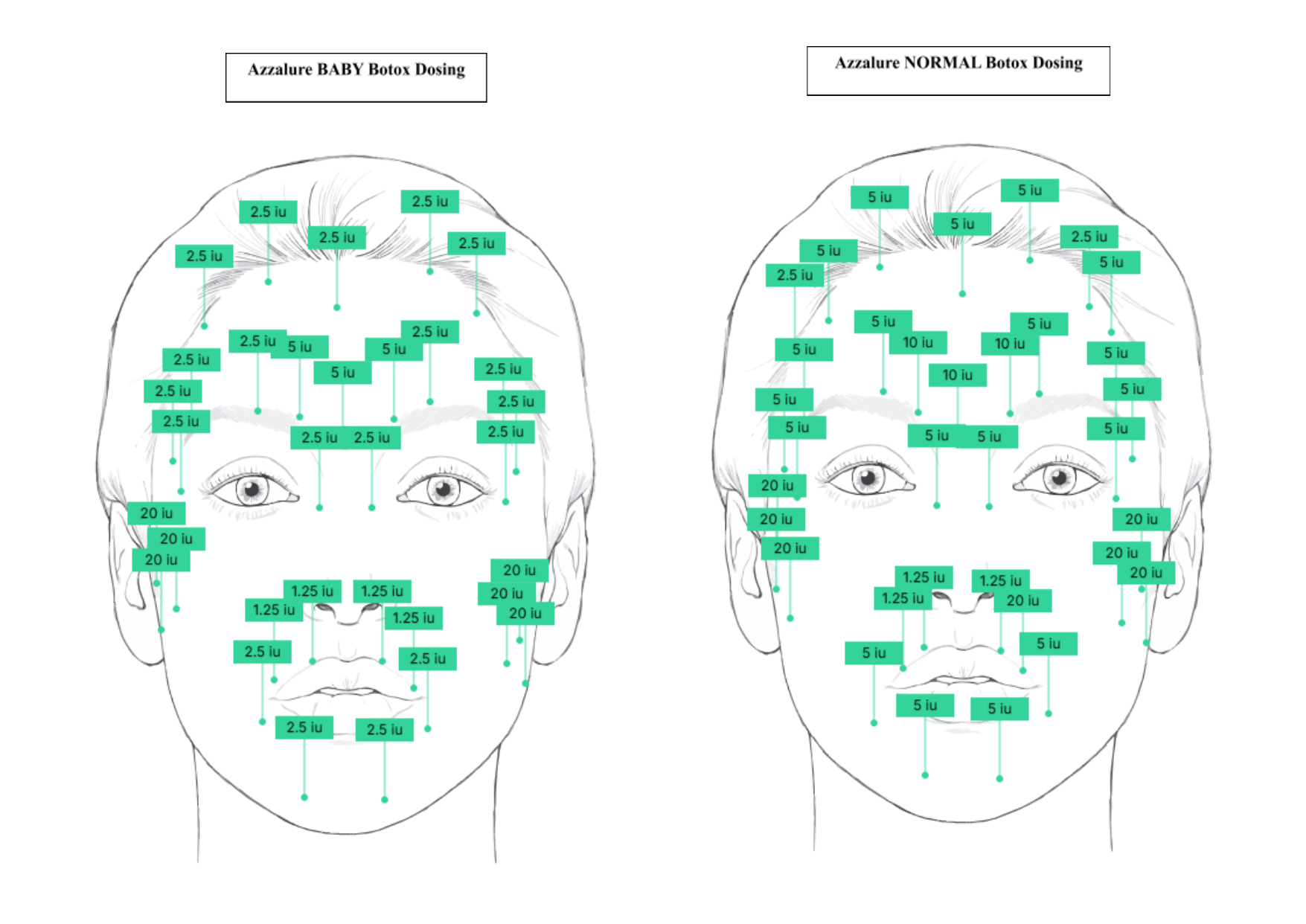Azzalure dosing chart, baby and normal